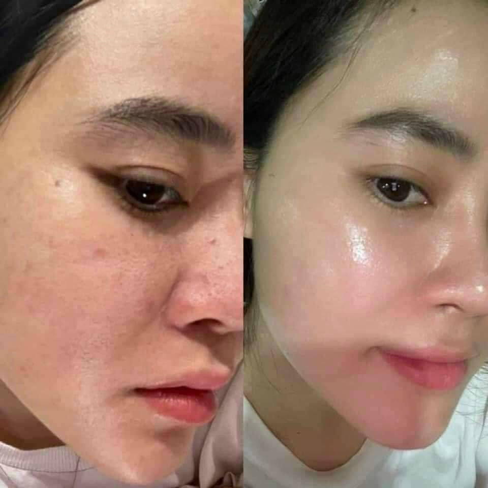 ZO BRIGHTALIVE SKIN BRIGHTENER 50ML