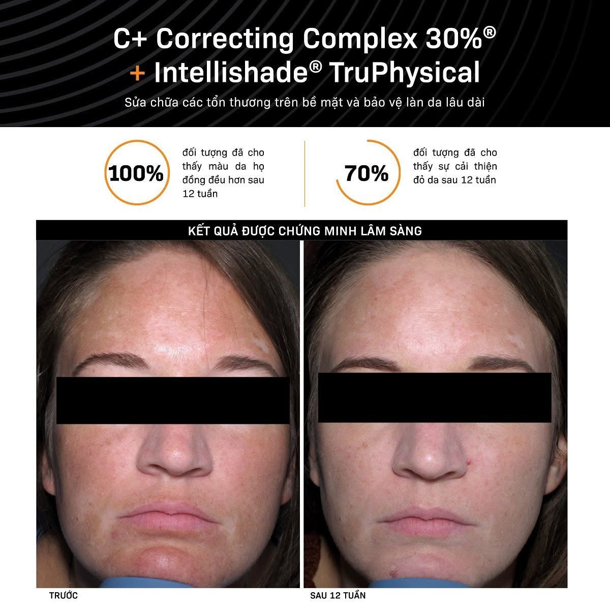 Revision C+ Correcting Complex 30ML