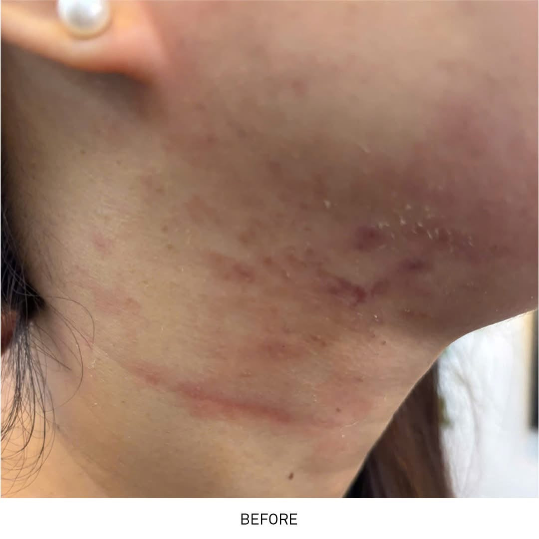 KEM DƯỠNG ẨM PHỤC HỒI CANDID B5 CICA