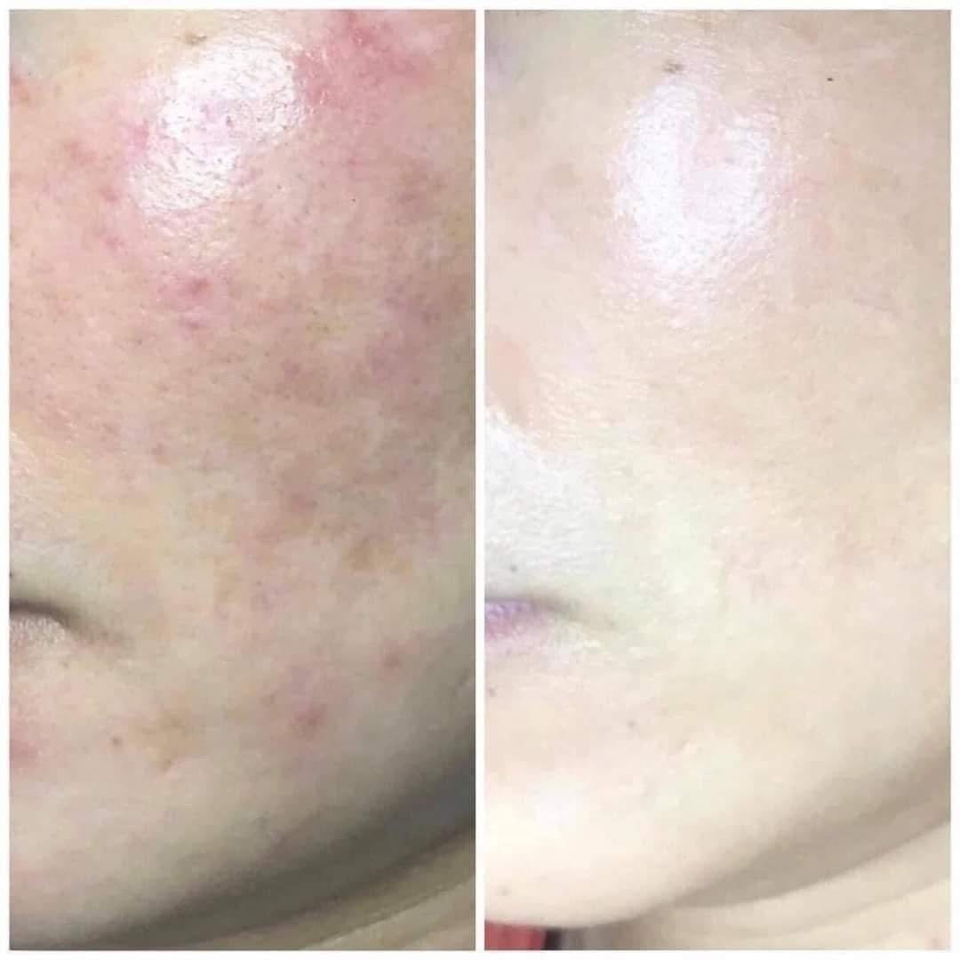SERUM PHYTO CORRECTIVE GEL