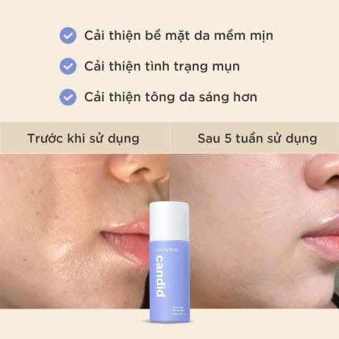 AHA & PHA CANDID 100ML