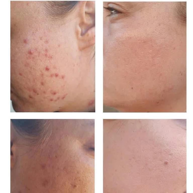 Nescens Zombie Cell Clearing Serum