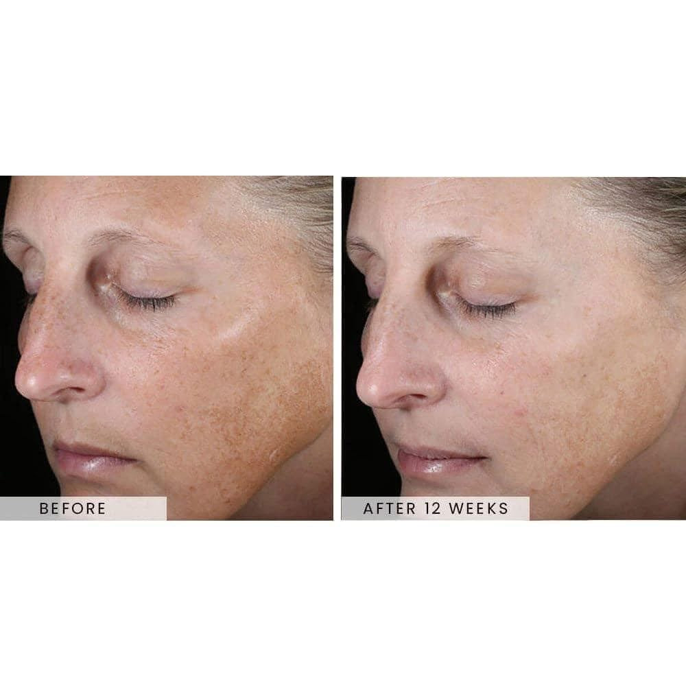 Skinbetter Science Serum Even Tone Corecting