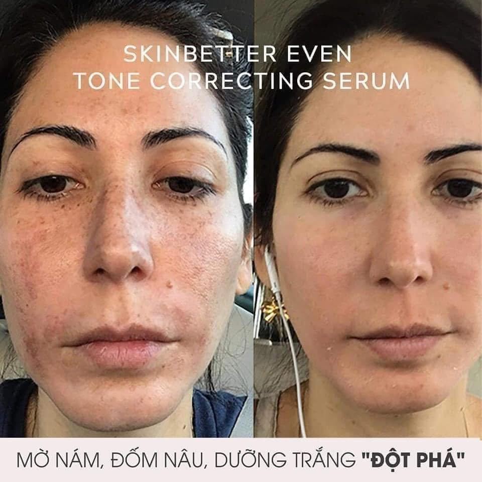 Skinbetter Science Serum Even Tone Corecting