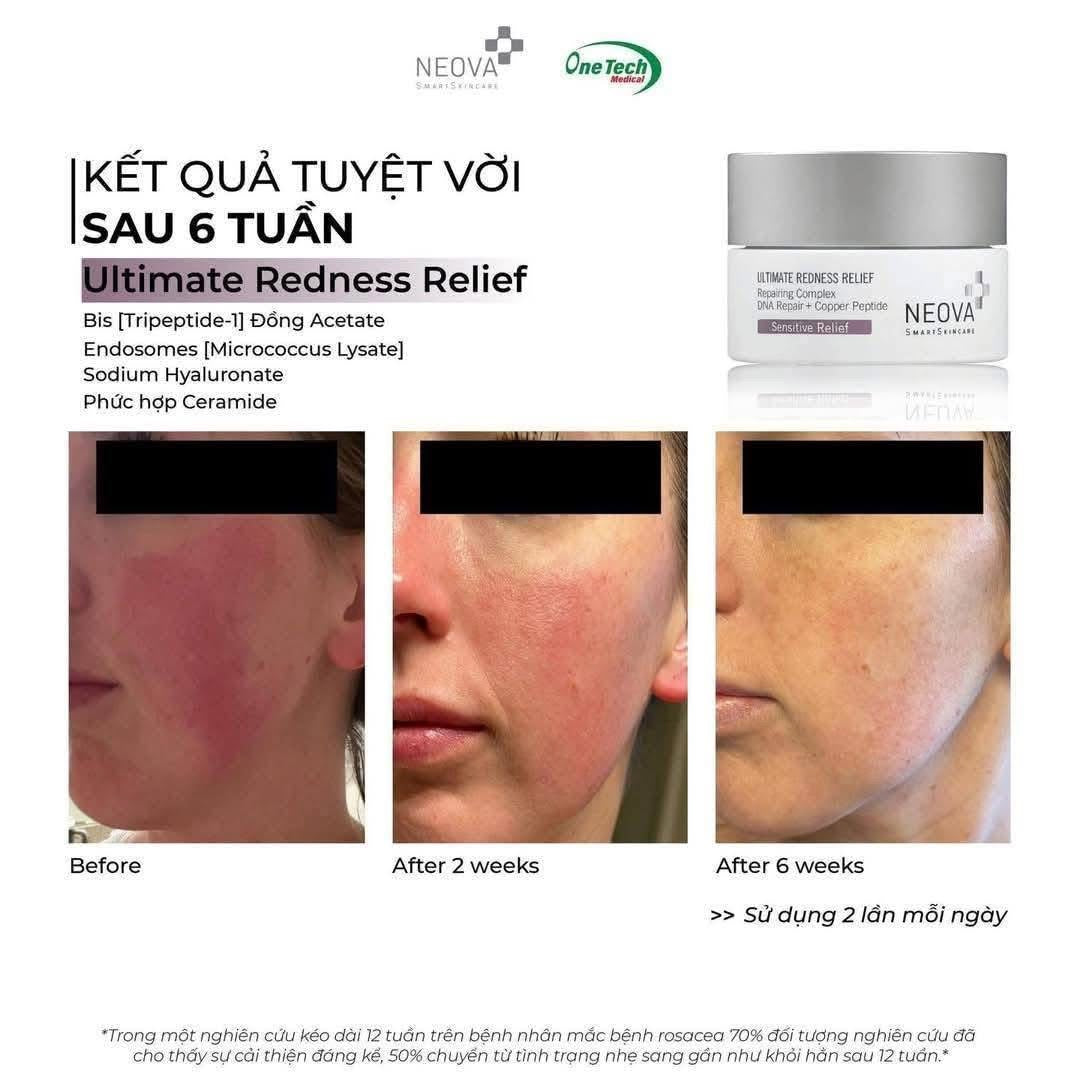 Neova Ultimate Redness Relief