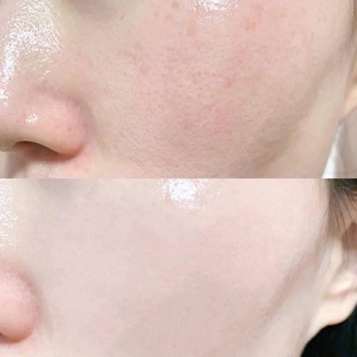 OBAGI RETINOL- PHIÊN BẢN MỚI