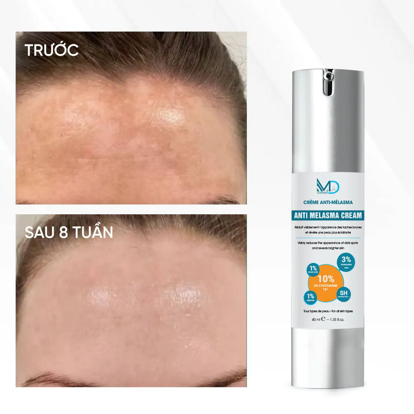 MD COSMEDI ANTI-MELASMA CREAM