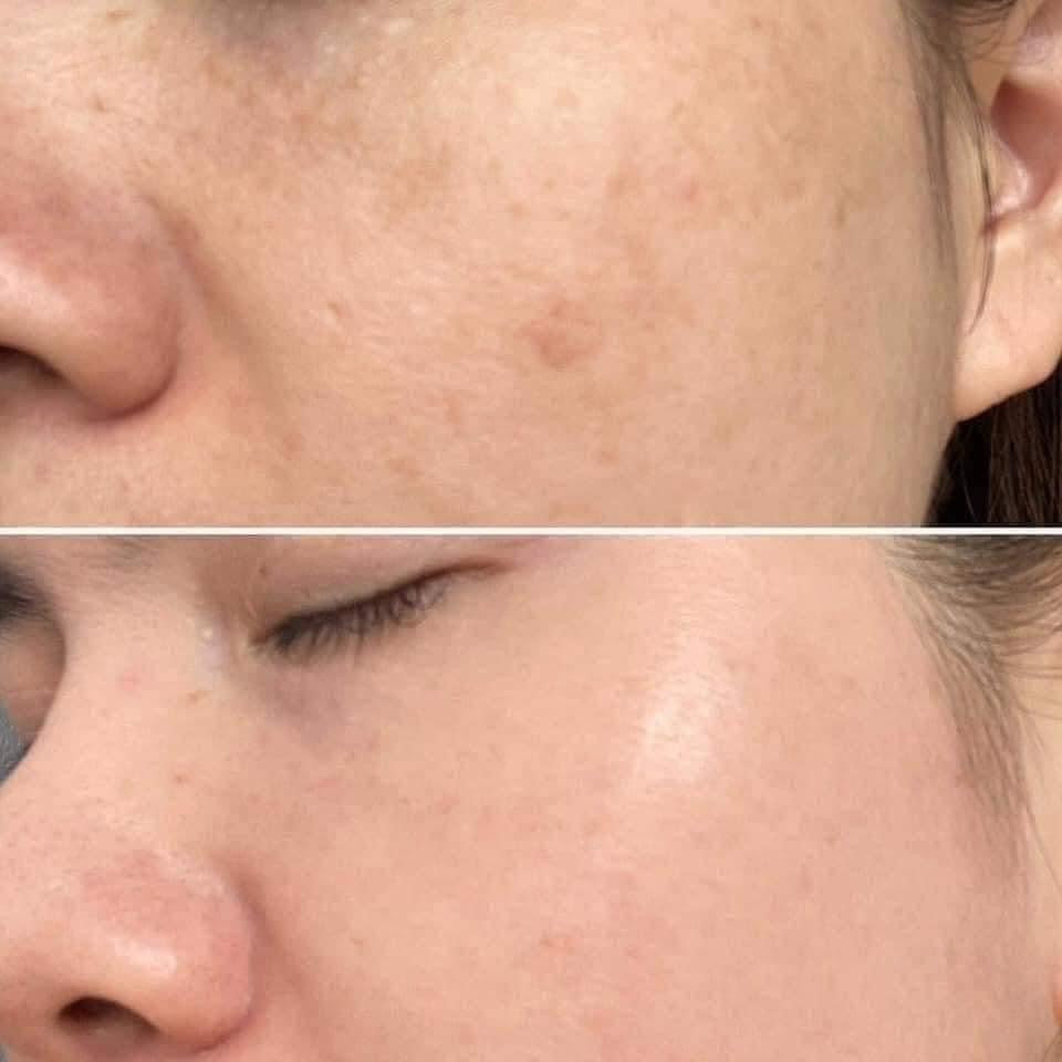 SERUM IMAGE ILLUMA INTENSE FACIAL ILLUMINATOR