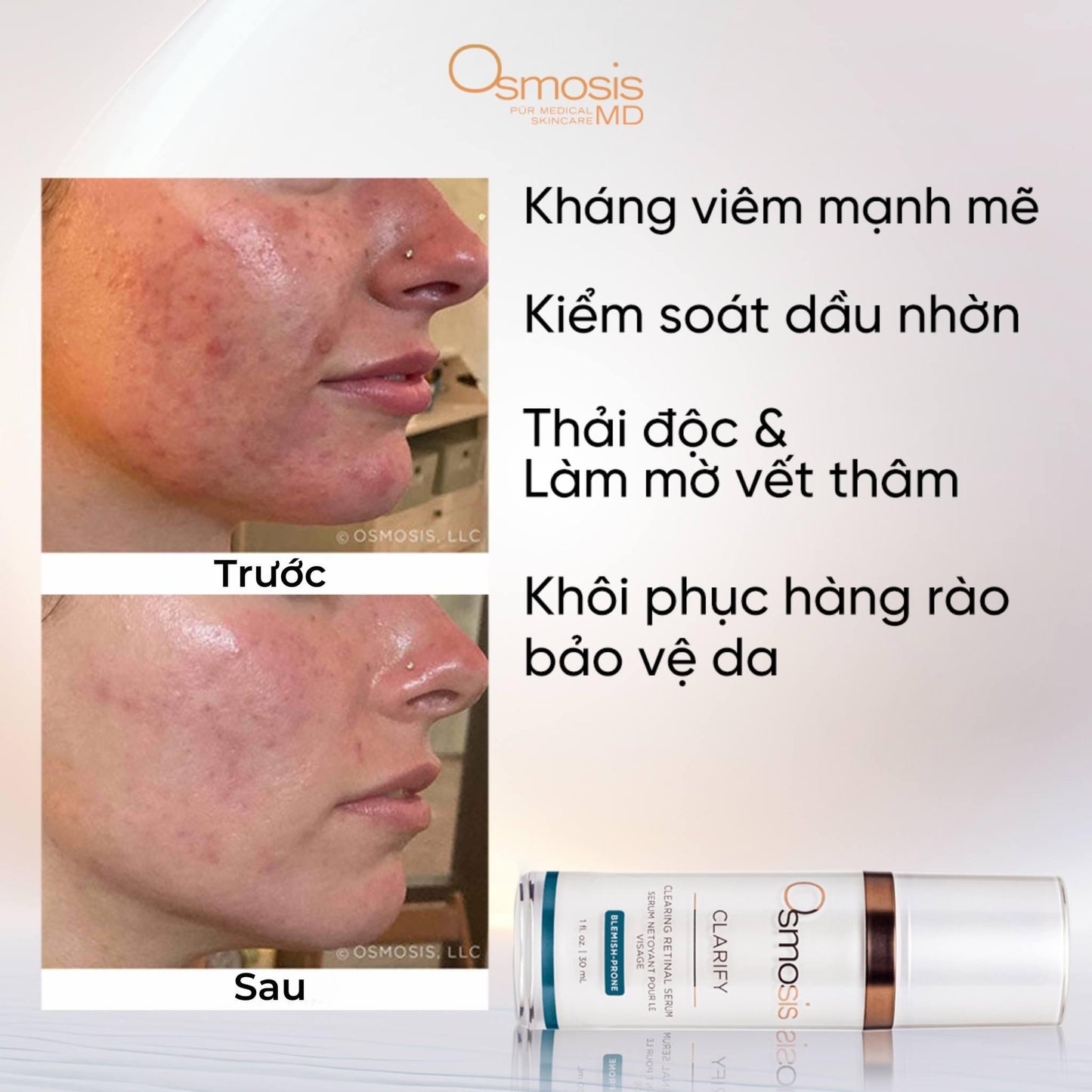 OSMOSIS SERUM CLARIFY