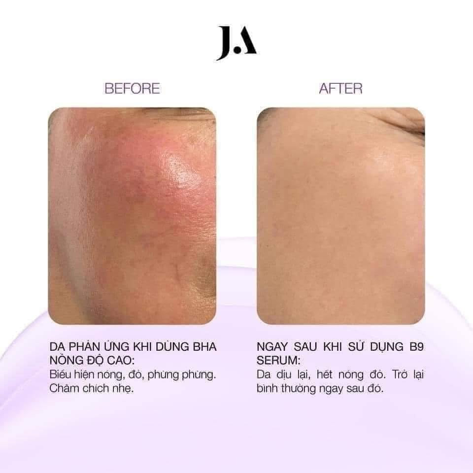 JA SERUM B9 55ML
