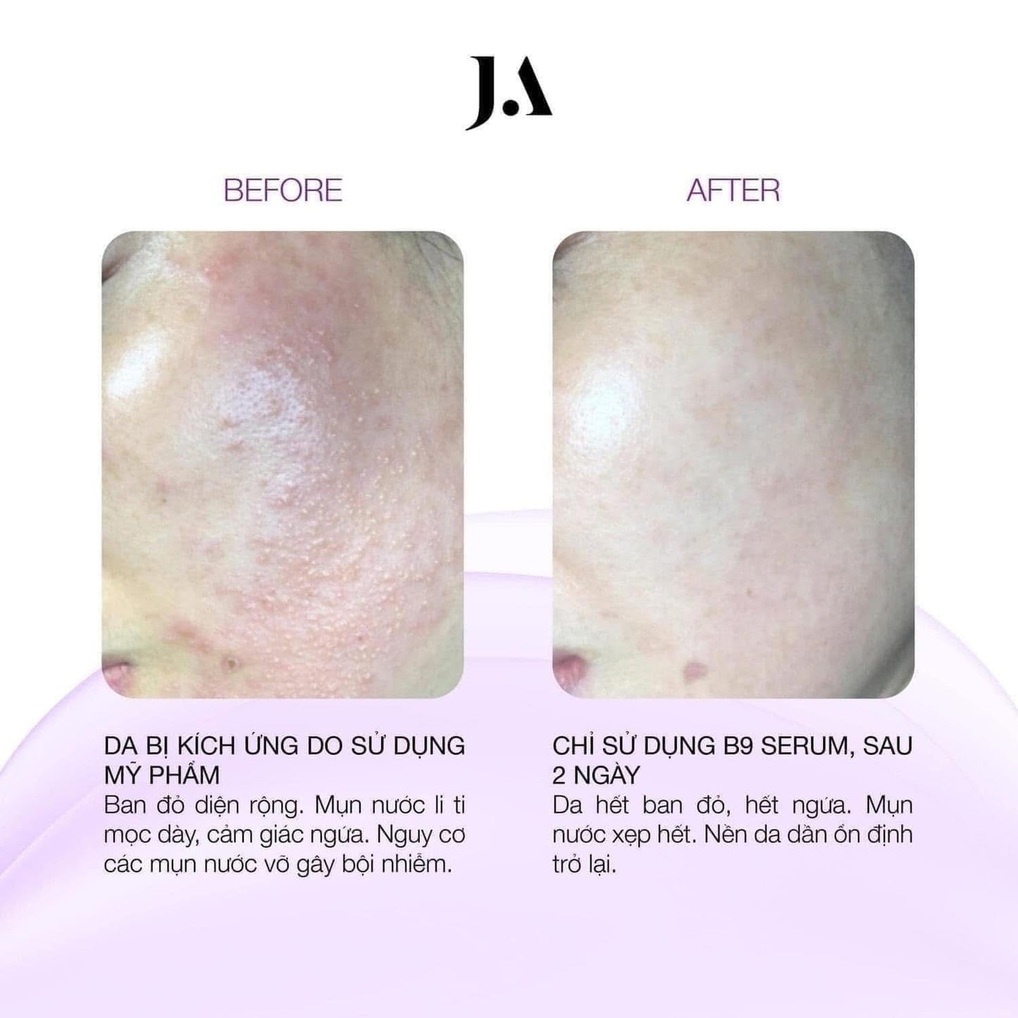 JA SERUM B9 55ML
