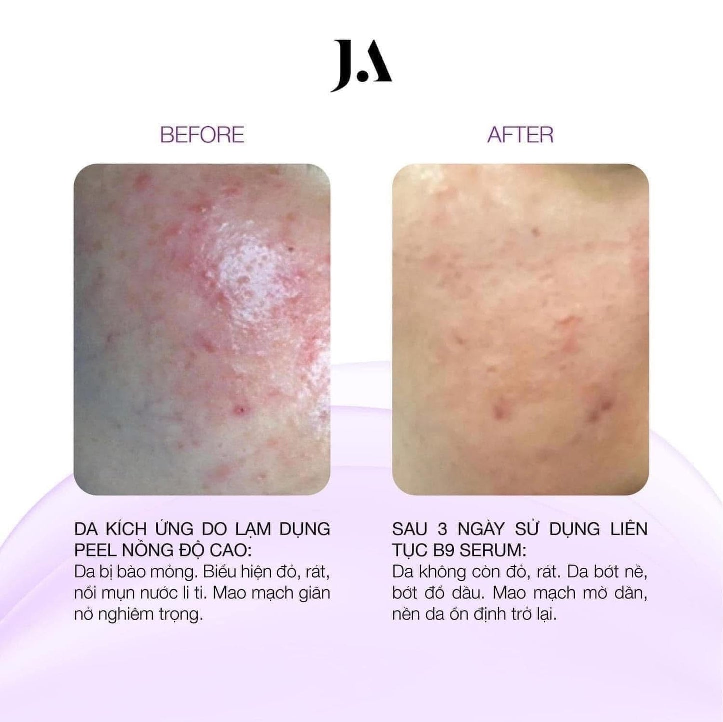 JA SERUM B9 55ML