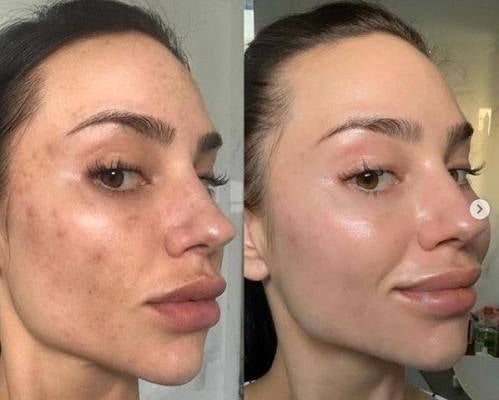 Mesoestetic Melan Tran3x Gel Cream