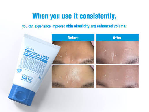 CONAPIDIL Cemenzal Light High Potency Cream – 100 mL