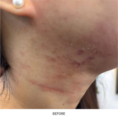 KEM DƯỠNG ẨM PHỤC HỒI CANDID B5 CICA