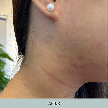 KEM DƯỠNG ẨM PHỤC HỒI CANDID B5 CICA