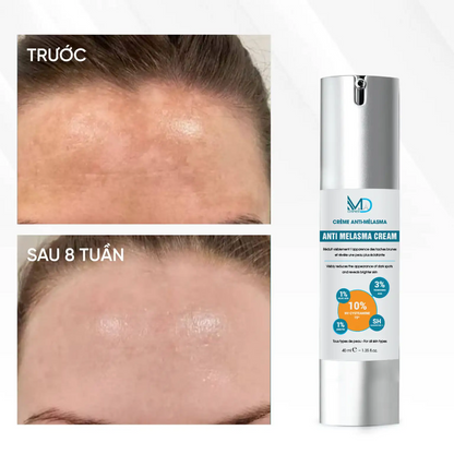 MD COSMEDI ANTI-MELASMA CREAM