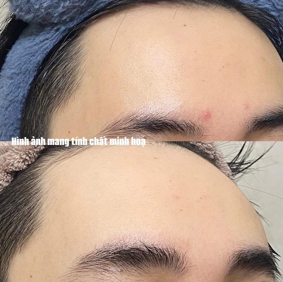 BABE STOP AKN REPAIRING MOISTURISER