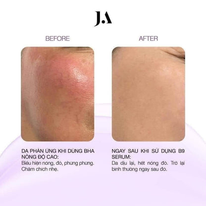 JA SERUM B9 55ML