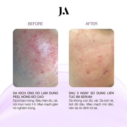 JA SERUM B9 55ML
